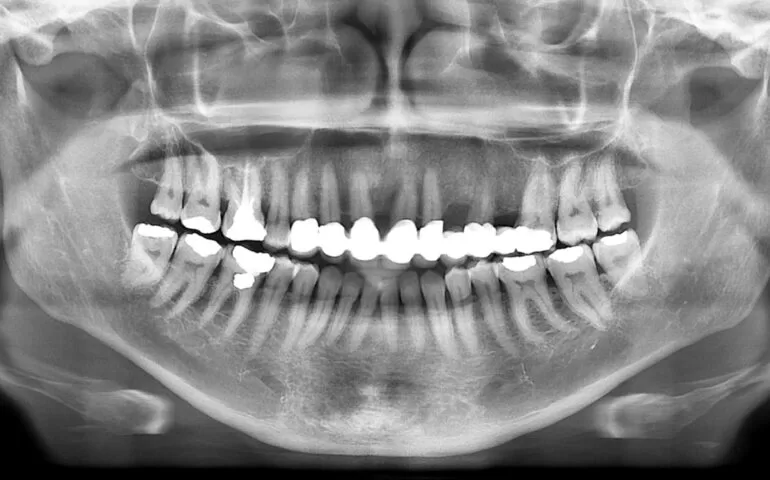 Digital and panoramic radiography - arslan klinik