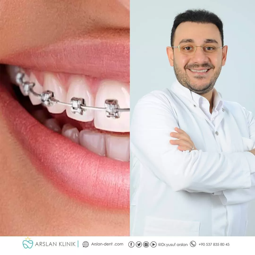 Orthodontics-and-jaws - arslan dental klinik