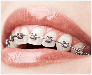 orthodontics-and-jaws-arslan-dental-klinik-yusuf-arslan-4